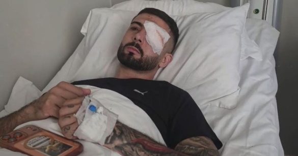 Lajm i mirë nga Roma – Erjon Vishkulli kalon me sukses operacionin, ndërhyrja i shpëton syrin